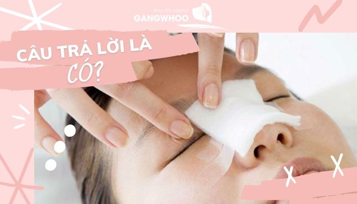 Giải đáp thắc mắc nâng mũi cấu trúc có tháo ra được không?