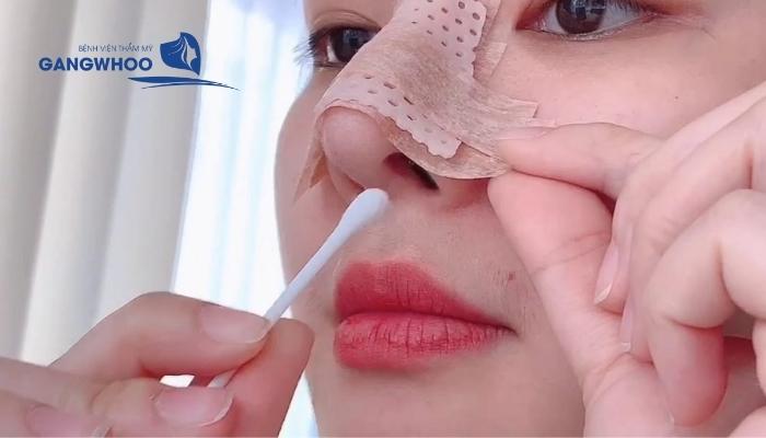 Vệ sinh kĩ lưỡng sau khi tháo mũi nâng cấu trúc