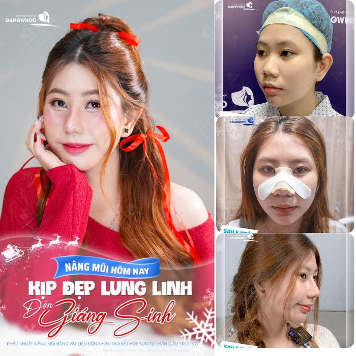 Địa điểm đáng tin cậy để tư vấn và thực hiện nâng mũi đẹp tự nhiên, bền vững