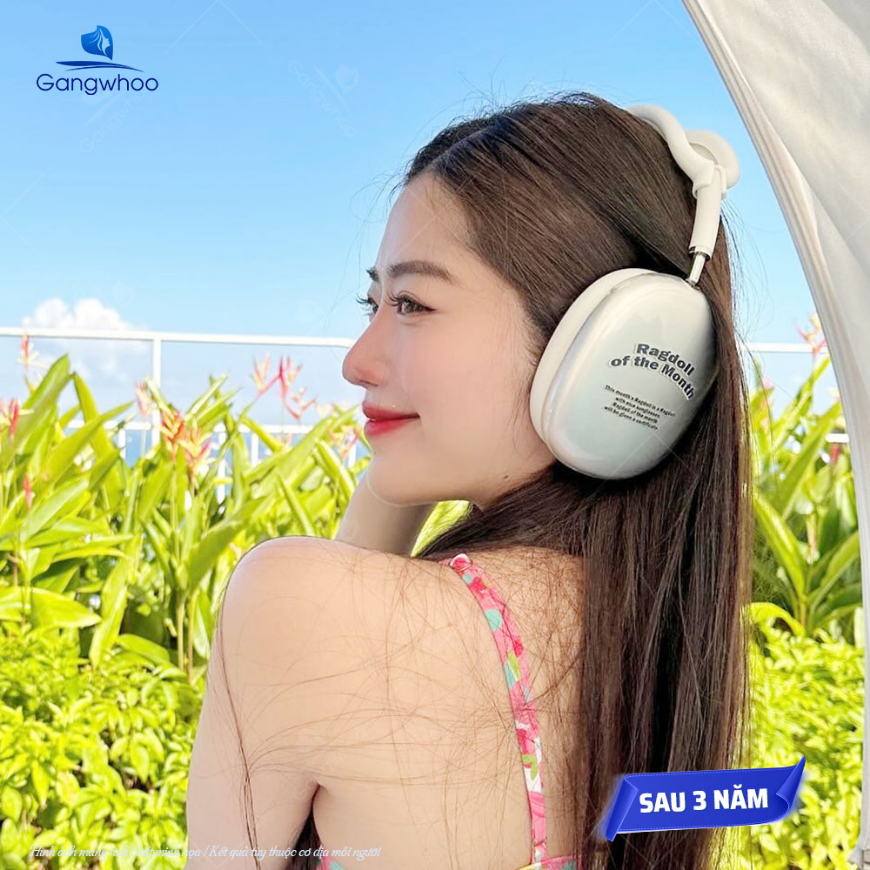 Kết quả lâu dài: mũi đẹp sau 3 năm nâng, không bị lệch hay bóng đỏ