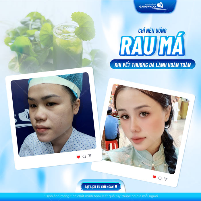 Nâng mũi uống rau má được không? Vì sao nên hạn chế?