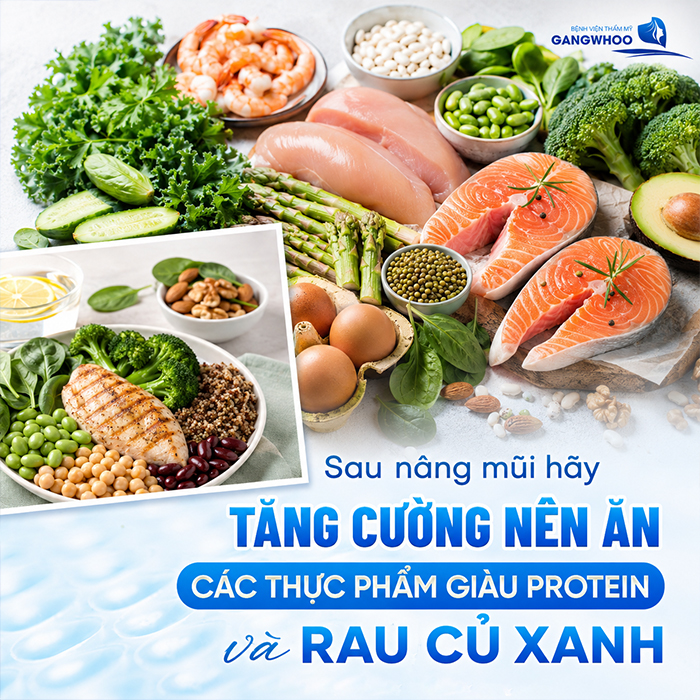 Nâng Mũi Ăn Tỏi Được Không? Bác Sĩ Giải Đáp Từ Góc Nhìn Y Khoa