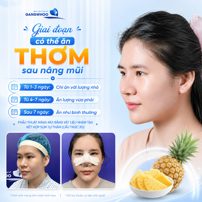 Nâng Mũi Ăn Thơm Được Không? Cách Ăn Dứa Giúp Mũi Nhanh Gom Form