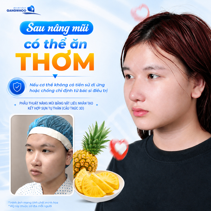 Nâng Mũi Ăn Thơm Được Không? Cách Ăn Dứa Giúp Mũi Nhanh Gom Form