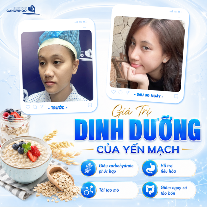Nâng Mũi Ăn Yến Mạch Được Không? Bác Sĩ Giải Đáp Chi Tiết