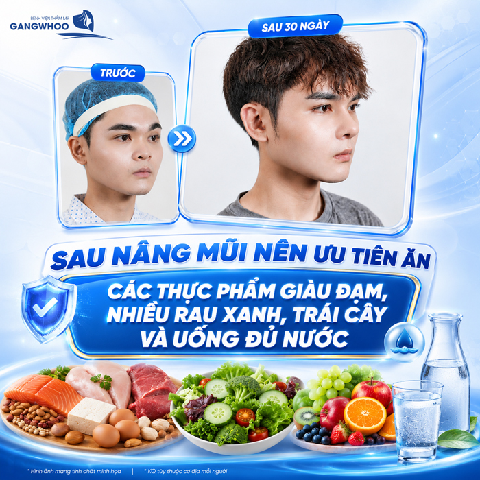 Nâng Mũi Ăn Chao Được Không? Bao Lâu Có Thể Ăn Lại?