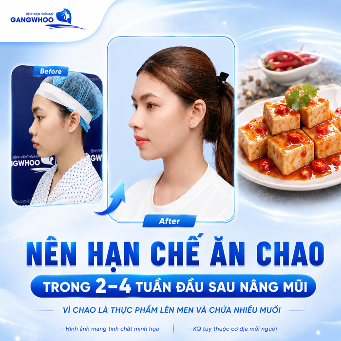 Nâng Mũi Ăn Chao Được Không? Bao Lâu Có Thể Ăn Lại?