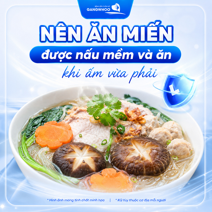 Nâng Mũi Ăn Miến Được Không? Bao Lâu Thì Ăn Được?