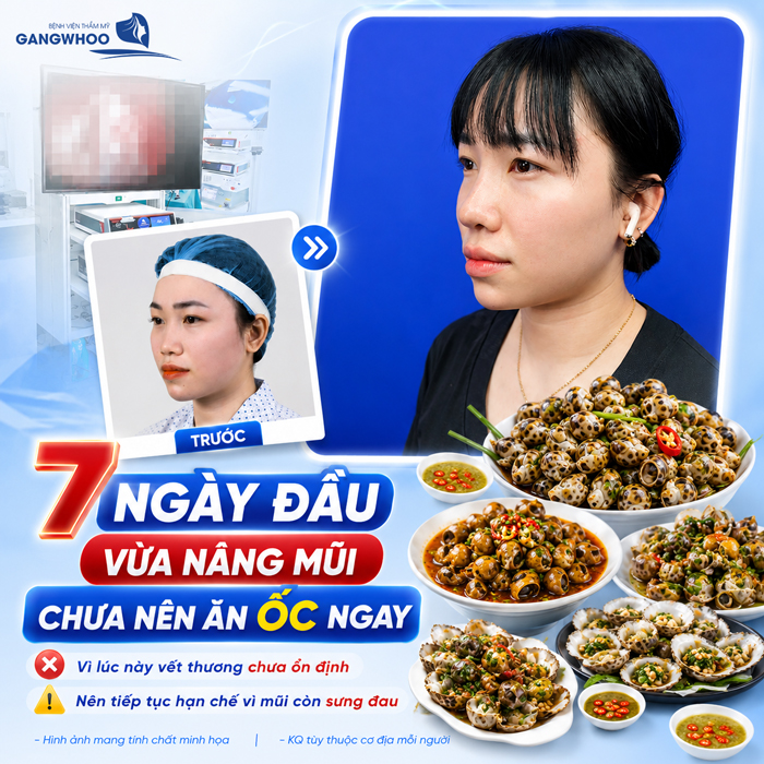 Nâng Mũi Ăn Được Ốc Không? Bác Sĩ Giải Đáp Chi Tiết