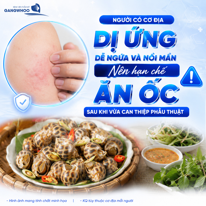 Nâng Mũi Ăn Được Ốc Không? Bác Sĩ Giải Đáp Chi Tiết