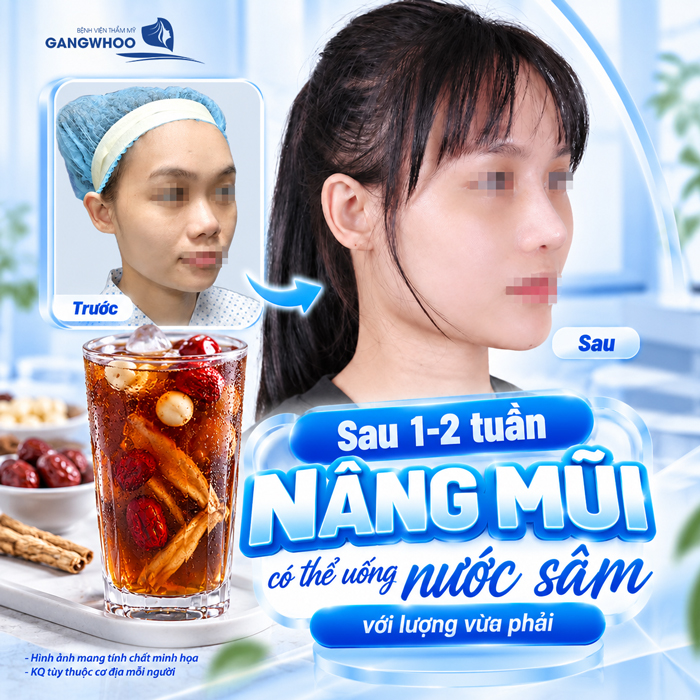Nâng Mũi Uống Nước Sâm Được Không? Bác Sĩ Giải Đáp Chi Tiết