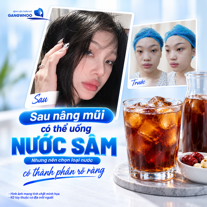 Nâng Mũi Uống Nước Sâm Được Không? Bác Sĩ Giải Đáp Chi Tiết