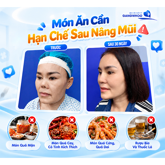 Nâng Mũi Ăn Chân Gà Được Không? Bác Sĩ Giải Đáp