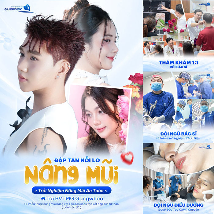 Nâng mũi an toàn tại BVTM Gangwhoo yên tâm sở hữu mũi đẹp tự nhiên, mềm mại và bền lâu