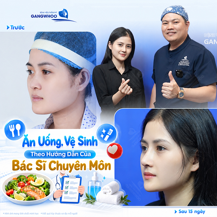 Nâng Mũi Bao Lâu Được Ăn Xì Dầu? Bác Sĩ Giải Đáp Chi Tiết
