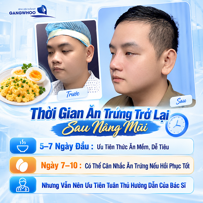 Nâng Mũi Bao Lâu Được Ăn Trứng Gà? Khi Nào Ăn Lại An Toàn?