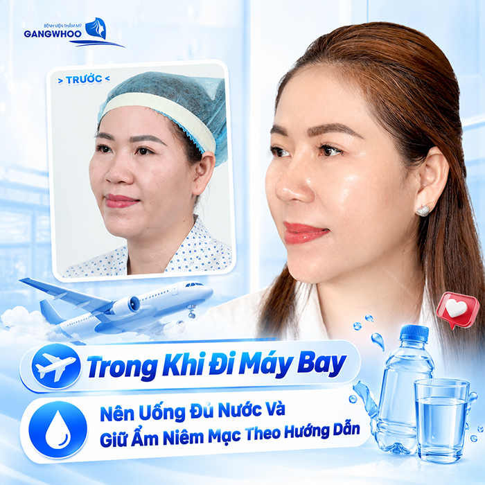 Nâng Mũi Bao Lâu Thì Đi Máy Bay Được? Bác Sĩ Giải Đáp