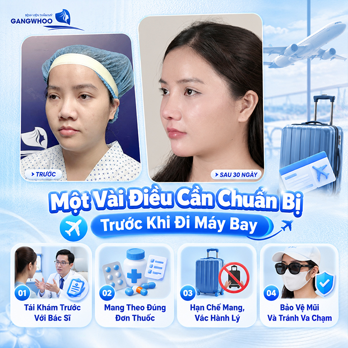 Nâng Mũi Bao Lâu Thì Đi Máy Bay Được? Bác Sĩ Giải Đáp
